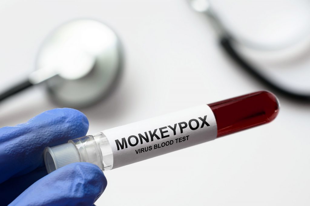 Monkeypox lab testing in Huntersville NC
